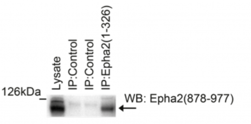 EPHA2