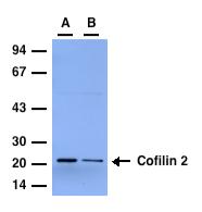 Cofilin