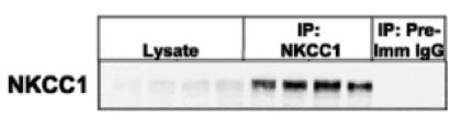 HEK 293 cell lysates (40 ug) or immunoprecipitates undertaken from 2 mg of HEK 293 cellular lysates with anti-NKCC1 (1-260) (5 ug) or pre-immune IgG were subjected to SDS-Page, transferred to nitrocellulose membrane and immunoblotted with anti-NKCC1 (1-260) (2 ug/ml). Binding of the primary antibody was detected using rabbit peroxidase conjugated anti- sheep IgG antibody (1 in 10, 000 dilution, Pierce) followed by enhanced chemiluminescence (ECL, Amersham). NKCC1
