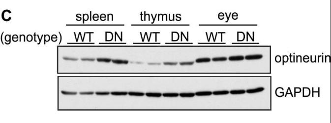 Optineurin